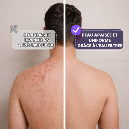 Orlinix- pommeaux de douche anticalcaires